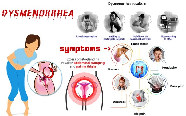 Dysmenorrhea